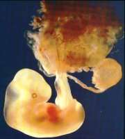 Embryo star� 5 t�dn� /5,2kB/20kB (500x379)