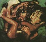 D�t� po otrav� sol� /6,6kB/24kB