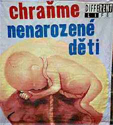 Nenarozen� �ivot /9,8kB